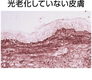 光老化していない皮膚