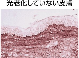 光老化していない皮膚
