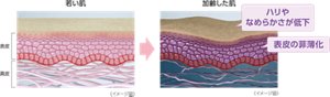 若い肌と加齢した肌のイメージ図