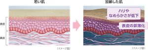 若い肌と加齢した肌のイメージ図