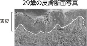 29歳の皮膚断面写真