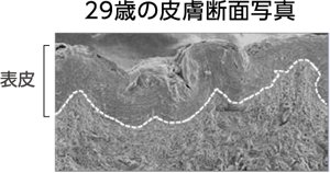 29歳の皮膚断面写真