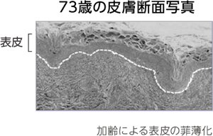 73歳の皮膚断面写真