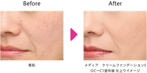 仕上がりイメージ Before After