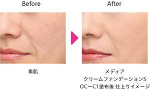 仕上がりイメージ Before After