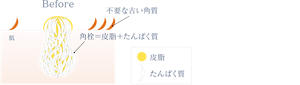 Before 肌に不要な古い角質と角栓が残っているイメージ