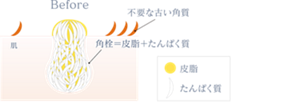 Before 肌に不要な古い角質と角栓が残っているイメージ