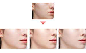 Before After Finished image(01) Finished image(02) Finished image(03)