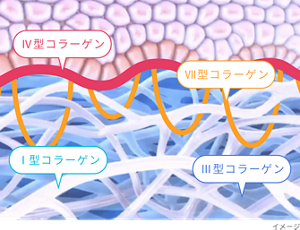 4種のコラーゲンのイメージ図