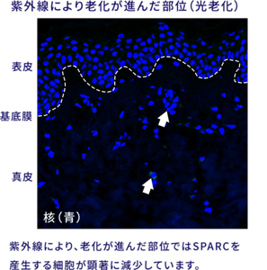 紫外線により老化が進んだ部位(光老化)の画像。 抗体を用いた蛍光染色にて調べたところ、紫外線により、老化が進んだ部位ではSPARCを産生する細胞が顕著に減少していました。