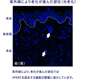 紫外線により老化が進んだ部位(光老化)の画像。 抗体を用いた蛍光染色にて調べたところ、紫外線により、老化が進んだ部位ではSPARCを産生する細胞が顕著に減少していました。