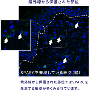 紫外線から保護された部位の画像。 抗体を用いた蛍光染色にて調べたところ、紫外線から保護された部位では、 SPARCを産生する細胞が多く見られました。