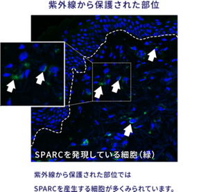 紫外線から保護された部位の画像。 抗体を用いた蛍光染色にて調べたところ、紫外線から保護された部位では、 SPARCを産生する細胞が多く見られました。
