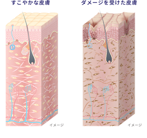 すこやかな皮膚とダメージを受けた皮膚のイメージ図