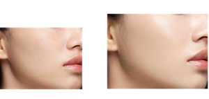 Before After 生ツヤ仕上げ 仕上がりイメージ(01)