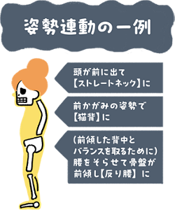 姿勢連動の一例図