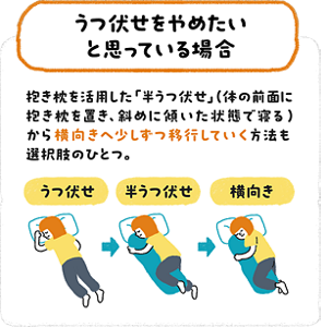 うつ伏せ寝をやめたい場合の方法。抱き枕を活用した半うつ伏せを経て、少しずつ横向き寝へ移行していく流れを示した図解