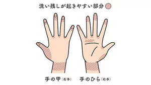 手の甲、手のひらで洗い残しが起きやすい部分のイメージイラスト