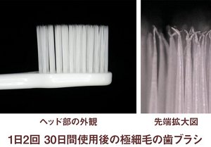 写真:1日2回、30日間使用後の極細毛の歯ブラシの外観と先端拡大図