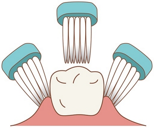 図:いろいろな角度から磨くイメージのイラスト