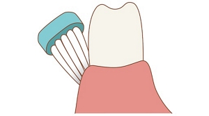図:歯ブラシの当て方のイラスト