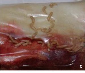 マゴットによるデブリードマンの処置画像