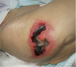 7日後の状態の写真