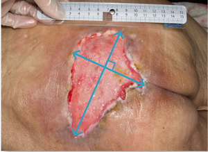 創サイズの計測写真