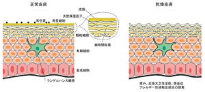 正常皮膚と乾燥皮膚をイメージしたイラスト。左は角層の乾燥を防ぐ3つの成分が正常に働いている正常皮膚のイメージ。右は3つの成分が正常に働いていない乾燥皮膚のイメージ。