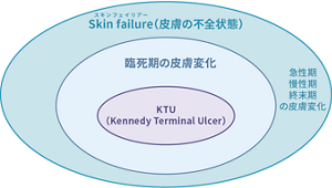 終末期に主にみられる皮膚の変化を表した概念図。一番外側にスキンフェイリアー(皮膚の不全状態)と急性期、慢性期、終末期の皮膚変化があり、その次に臨死期の皮膚変化、最期にKennedy Terminal Ulcerが配置されている。