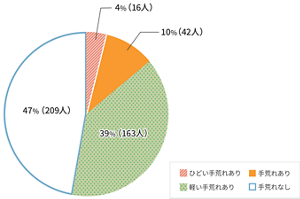 手荒れのあるスタッフ様の状況を表すグラフ。ひどい手荒れあり4%、手荒れありと回答した方が全体の14%。50人以上のスタッフ様が手荒れに悩んでいることがわかった。