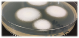 採取してシャーレで培養した白癬菌の写真。