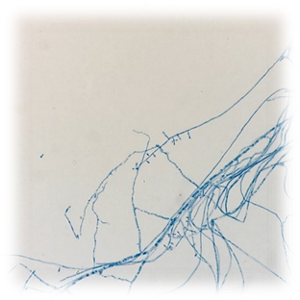 紅色白癬菌を染色し顕微鏡で確認した写真。