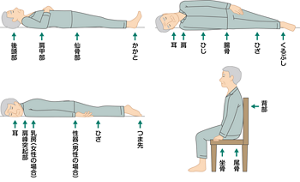 褥瘡発生の危険性が高い骨突出部位を表すイラスト。〈仰臥位(仰向け)の場合〉後頭部、肩甲部、仙骨部、かかとがベッドや布団に接している。〈側臥位(横向き)の場合〉耳、肩、ひじ、腸骨、ひざ、くるぶしがベッドや布団に接している。〈腹臥位(うつ伏せ)の場合〉耳、肩峰突起部、乳房(女性の場合)、性器(男性の場合)、ひざ、つま先がベッドや布団に接している。〈座位(着席)の場合〉背部、尾骨、坐骨が椅子に接している。