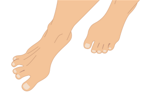 右足の指を大きく広げているイラスト