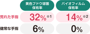 荒れた手指と健常な手指の黄色ブドウ球菌、バイオフィルムの保有率をあらわす表。荒れた手指は黄色ブドウ球菌保有率が32%、バイオフィルム保有率が14%。健常な手指は黄色ブドウ球菌保有率は6%、バイオフィルム保有率は0%。