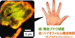 手指を顕微鏡で拡大した写真。黄色ブドウ球菌とバイオフィルム構成物質が存在している。