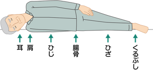 姿勢:側臥位(横向き)を表すイラスト。耳、肩、ひじ、腸骨、ひざ、くるぶしがベッドや布団に接していることがわかる。