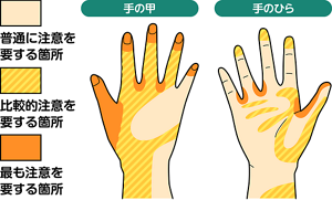 手洗い時に注意を要する箇所を表すイラスト。