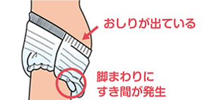 おむつの引き上げが不十分で、おしりが出ていたり脚まわりにすき間が発生しているイラスト