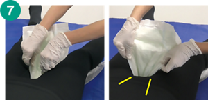 7.パッドをご利用者様のそけい部に沿わせて装着している画像。