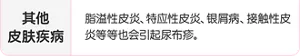 其他 皮肤疾病:脂溢性皮炎、特应性皮炎、银屑病、接触性皮炎等等也会引起尿布疹。