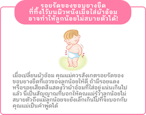 รอยรัดของขอบยางยืดที่ทิ้งไว้บนผิวหนังเมื่อใส่ผ้าอ้อมอาจทำให้ลูกน้อยไม่สบายตัวได้!