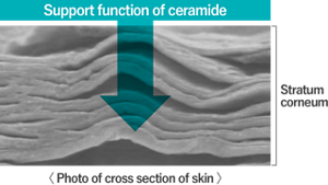 Photo of cross section of skin