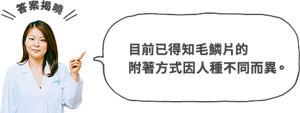 目前已得知毛鱗片的 附著方式因人種不同而異。