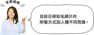 目前已得知毛鱗片的 附著方式因人種不同而異。