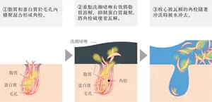 ①脂質和蛋白質於毛孔內積聚混合形成角栓。②重點洗顏啫喱有效將脂質溶解,抑制蛋白質凝聚,將角栓破壞並瓦解。③核心被瓦解的角栓隨著沖洗時被水沖去。