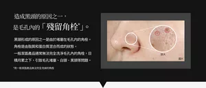 造成黑頭的原因之一, 是毛孔內的「殘留角栓*」 。  黑頭形成的原因之一是由於堵塞在毛孔内的角栓。角栓是由脂質和蛋白質混合而成的狀態。 一般潔面產品通常無法完全洗淨毛孔內的角栓,日積月累之下,引致毛孔堵塞、白頭、黑頭等問題。  *用一般潔面產品無法完全洗掉的角栓