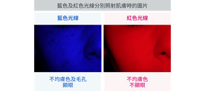 藍色及紅色光線分別照射肌膚時的圖片
