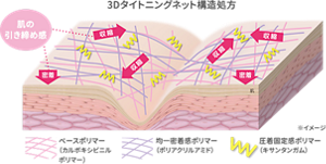 3Dタイトニングネット構造処方のイメージ図